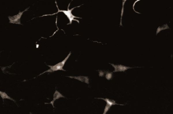 В клетках кожи человека обнаружили странные связи, похожие на нейроны